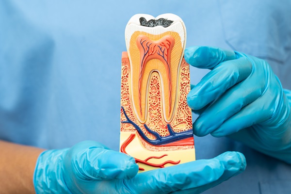 The Root Canal Procedure Explained: Step By Step